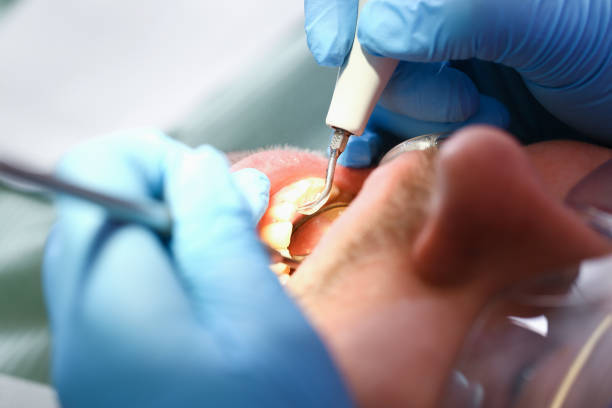 Best Emergency Denture Repair in Goshen, CA
