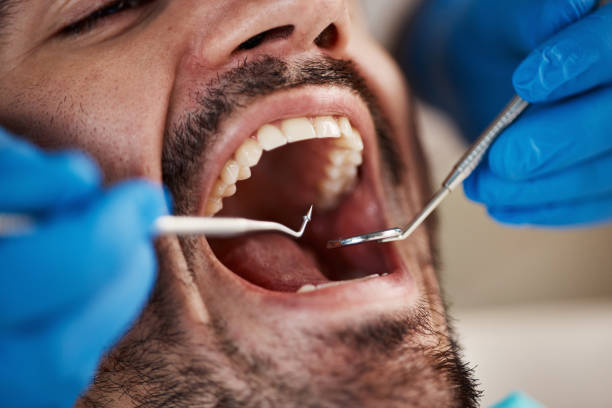Best Emergency Care for Gum Disease in Goshen, CA